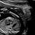 19w,0d 