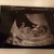11 weken baby #2 