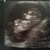 10+1 wk 