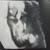 Babygirl 12+3 4D echo kleine prinses