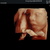pretecho 29 wk 