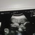 Baby 28 weken oud Onze zoon sabbelt aan zijn grote teen