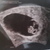 Eerste echo 19-4 7w3d