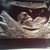 11 wk 3 dagen  