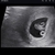 Eerste echo 