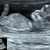 11WK4DG 