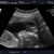 21 weken, termijnecho Toch een spannend moment die "twintig"weken-echo. Trots zijn we op onze kleine en in de zevende hemel als we te horen krijgen dat er geen afwijkingen te zien zijn!
