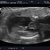 It's a boy! Wauw! Ja overduidelijk: we krijgen een zoon!!