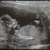 Boy or girl 