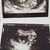 11w 4d Babyyy