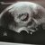 Eerste echo 8w3d 