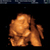 Pret echo   26 wkn 4 dgn 
