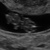 8w4d Tweede echo gehad. Het is goed gegroeid en precies op termijn!