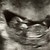 11w6d termijn echo 