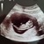 11 weekjes 