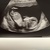 Baby 3  