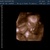 27 en halve week 3D echo 18 maart 2013 2/3/4D echo gehad, 27,5 week, echt heel mooi!!!  
