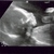 20 weken wonder Ons kleine wondertje!
