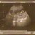  12 weken :) zwanger.... ondertussen alweer 17w3d :)