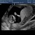 13 w en 2 d  