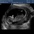 echo 13 w en 2 d 