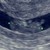9w4d 