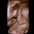 20weken echo3d 