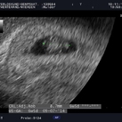 Pukkie Eerste pasfoto van ons ukkie!