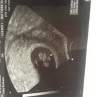 ook eerste echo 