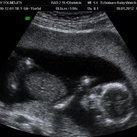 Een zoon 18-1-2012 
