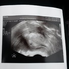 1e WONDER 5 weken zwanger