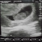 Echo 4 maart 2014 8.5 week zwanger!