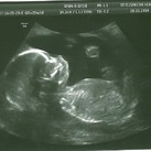 20w 3dagen 
