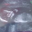 4de echo ( 2 - juni - 2014 ) 15 weken en 5 dagen zwanger 