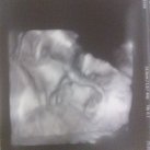 3d echo 27 wk 