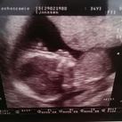 16 weken, 1 dag ons meisje!! I'm a girl!!