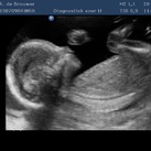 Ons tweede wondertje 