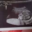 onze frummel 