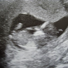 baby verbeek 
