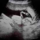 zo lief ! 14wk en 6 dagen Je deed eventjes zwaaien ! :D