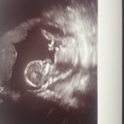  Ons wondertje 