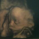 evelyn ik ben nu 22 weken zwanger van mijn 4e kindje en twee dame, ze heet evelyn en wordt rond 7 jan. verwacht