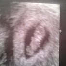 Echo week 9 