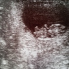 8 wkn echo 