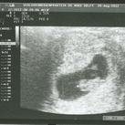 Eerste echo :D De eerste echo, gekregen op 9 weken zwangerschap. maar de termijn was niet goed via de echo te bepalen. Dat komt bij de volgende :D