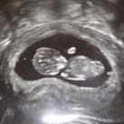 10w4d 
