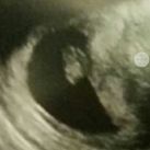  7 wk
