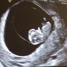 Termijn Echo Baby Bem 9 weken en 6 dagen oud en is nu 3,06 cm lang. 