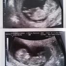 Ons 3e wondertje 