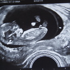 11w5d 
